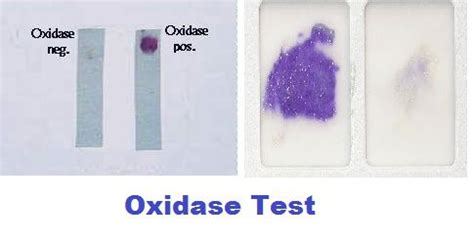 pseudomonas aeruginosa oxidase test
